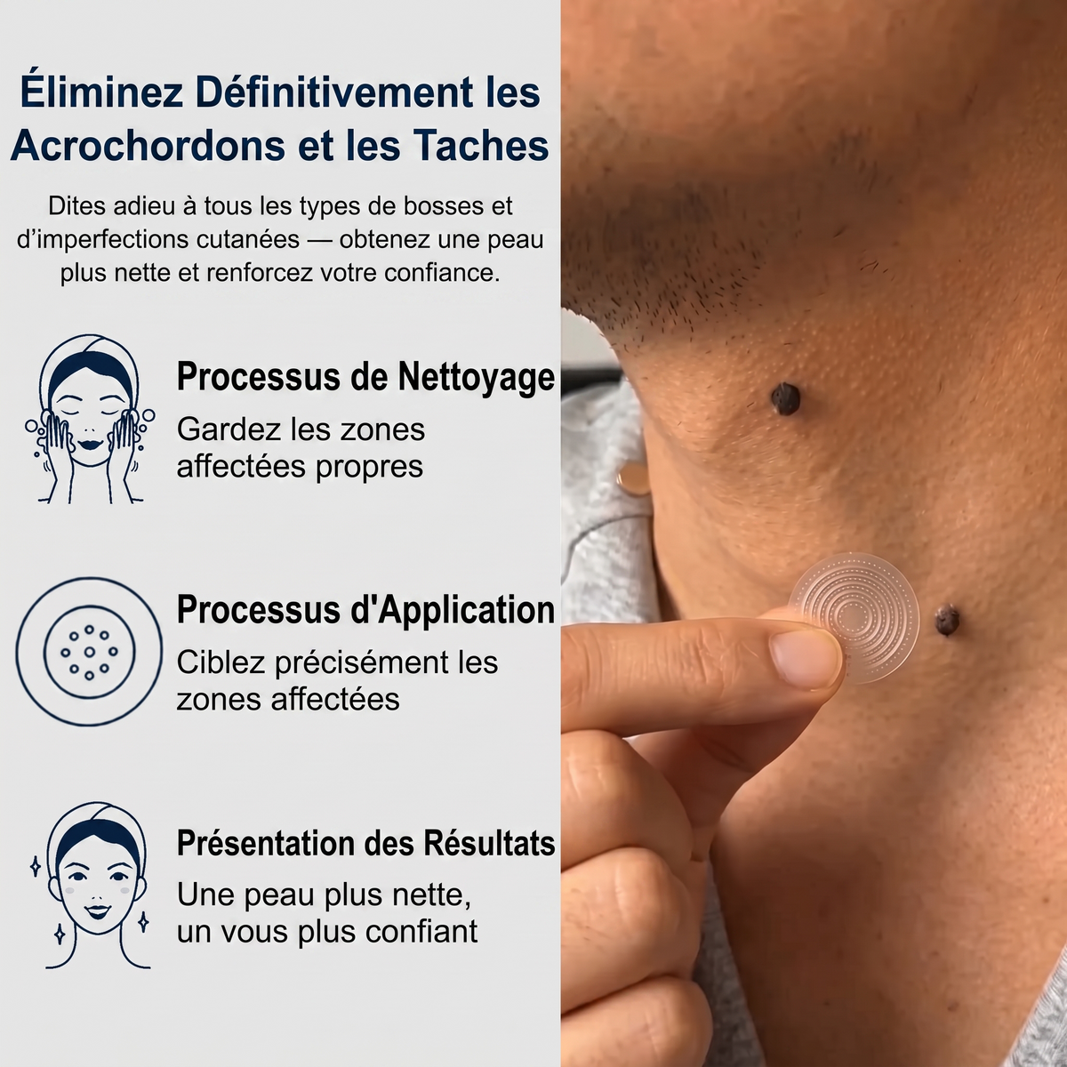【 Dernier jour : -70 % 🔥】🇫🇷 𝐇𝐞𝒂𝒍𝗿𝗶𝙯𝙚®🦋 𝑷𝒂𝒕𝒄𝒉 2-𝒆𝒏-1 à 𝒎𝒊𝒄𝒓𝒐-𝒂𝒊𝒈𝒖𝒊𝒍𝒍𝒆𝒔 & 𝒉𝒚𝒅𝒓𝒐𝒄𝒐𝒍𝒍𝒐ï𝒅𝒆 | Aide à réduire l’apparence des grains de beauté, verrues, acné et étiquettes cutanées | Patchs invisibles visage & corps.