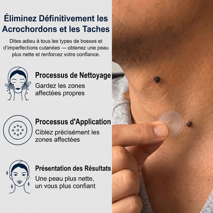 【 Dernier jour : -70 % 🔥】🇫🇷 𝐇𝐞𝒂𝒍𝗿𝗶𝙯𝙚®🦋 𝑷𝒂𝒕𝒄𝒉 2-𝒆𝒏-1 à 𝒎𝒊𝒄𝒓𝒐-𝒂𝒊𝒈𝒖𝒊𝒍𝒍𝒆𝒔 & 𝒉𝒚𝒅𝒓𝒐𝒄𝒐𝒍𝒍𝒐ï𝒅𝒆 | Aide à réduire l’apparence des grains de beauté, verrues, acné et étiquettes cutanées | Patchs invisibles visage & corps.