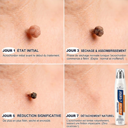 Recommandé par les pharmaciens 👨‍⚕️ 𝑯𝒆𝒂𝒍𝒓𝒊𝒛𝒆® 𝑺𝒕𝒚𝒍𝒐 𝑹𝒐𝒍𝒍𝒆𝒓 𝑨𝒏𝒕𝒊-𝑰𝒎𝒑𝒆𝒓𝒇𝒆𝒄𝒕𝒊𝒐𝒏𝒔 7 𝑱𝒐𝒖𝒓𝒔 𝑺𝒂𝒏𝒔 𝒅𝒐𝒖𝒍𝒆𝒖𝒓 • 𝑺𝒂𝒏𝒔 𝒎𝒂𝒓𝒒𝒖𝒆𝒔 𝒗𝒊𝒔𝒊𝒃𝒍𝒆𝒔