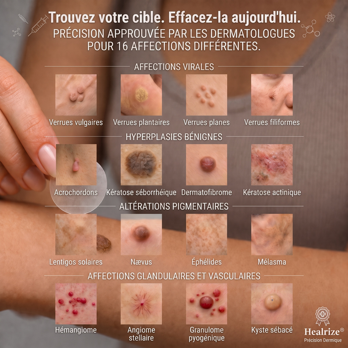 🔥 Plus que 10 paquets disponibles ! 30 % de réduction supplémentaire ! 𝐇𝐞𝒂𝒍𝗿𝗶𝙯𝙚® Patch 2-en-1 à micro-aiguilles & hydrocolloïde | Aide à réduire l’apparence des grains de beauté, verrues, acné et étiquettes cutanées | Patchs invisibles visage & corps.