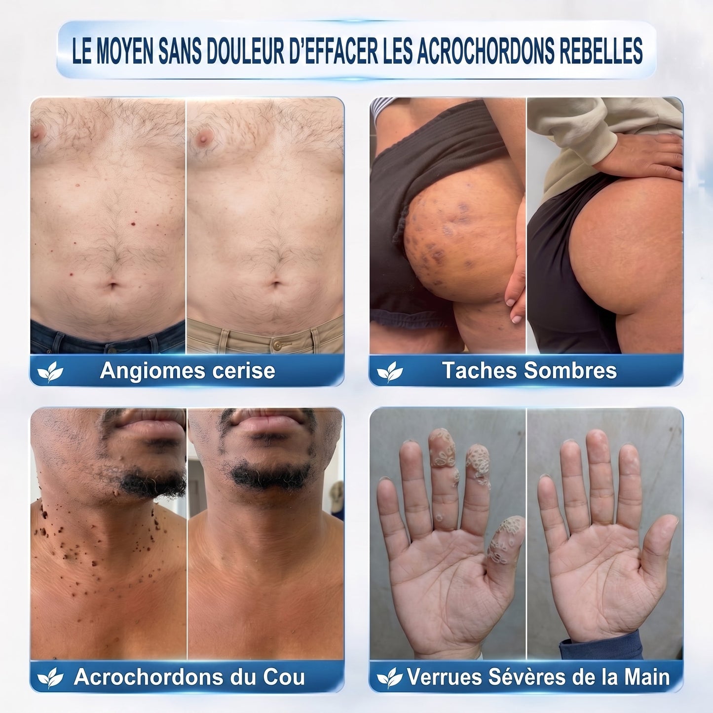 Recommandé par les pharmaciens 👨‍⚕️ 𝑯𝒆𝒂𝒍𝒓𝒊𝒛𝒆® 𝑺𝒕𝒚𝒍𝒐 𝑹𝒐𝒍𝒍𝒆𝒓 𝑨𝒏𝒕𝒊-𝑰𝒎𝒑𝒆𝒓𝒇𝒆𝒄𝒕𝒊𝒐𝒏𝒔 7 𝑱𝒐𝒖𝒓𝒔 𝑺𝒂𝒏𝒔 𝒅𝒐𝒖𝒍𝒆𝒖𝒓 • 𝑺𝒂𝒏𝒔 𝒎𝒂𝒓𝒒𝒖𝒆𝒔 𝒗𝒊𝒔𝒊𝒃𝒍𝒆𝒔