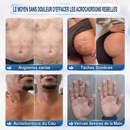 Recommandé par les pharmaciens 👨‍⚕️ 𝑯𝒆𝒂𝒍𝒓𝒊𝒛𝒆® 𝑺𝒕𝒚𝒍𝒐 𝑹𝒐𝒍𝒍𝒆𝒓 𝑨𝒏𝒕𝒊-𝑰𝒎𝒑𝒆𝒓𝒇𝒆𝒄𝒕𝒊𝒐𝒏𝒔 7 𝑱𝒐𝒖𝒓𝒔 𝑺𝒂𝒏𝒔 𝒅𝒐𝒖𝒍𝒆𝒖𝒓 • 𝑺𝒂𝒏𝒔 𝒎𝒂𝒓𝒒𝒖𝒆𝒔 𝒗𝒊𝒔𝒊𝒃𝒍𝒆𝒔