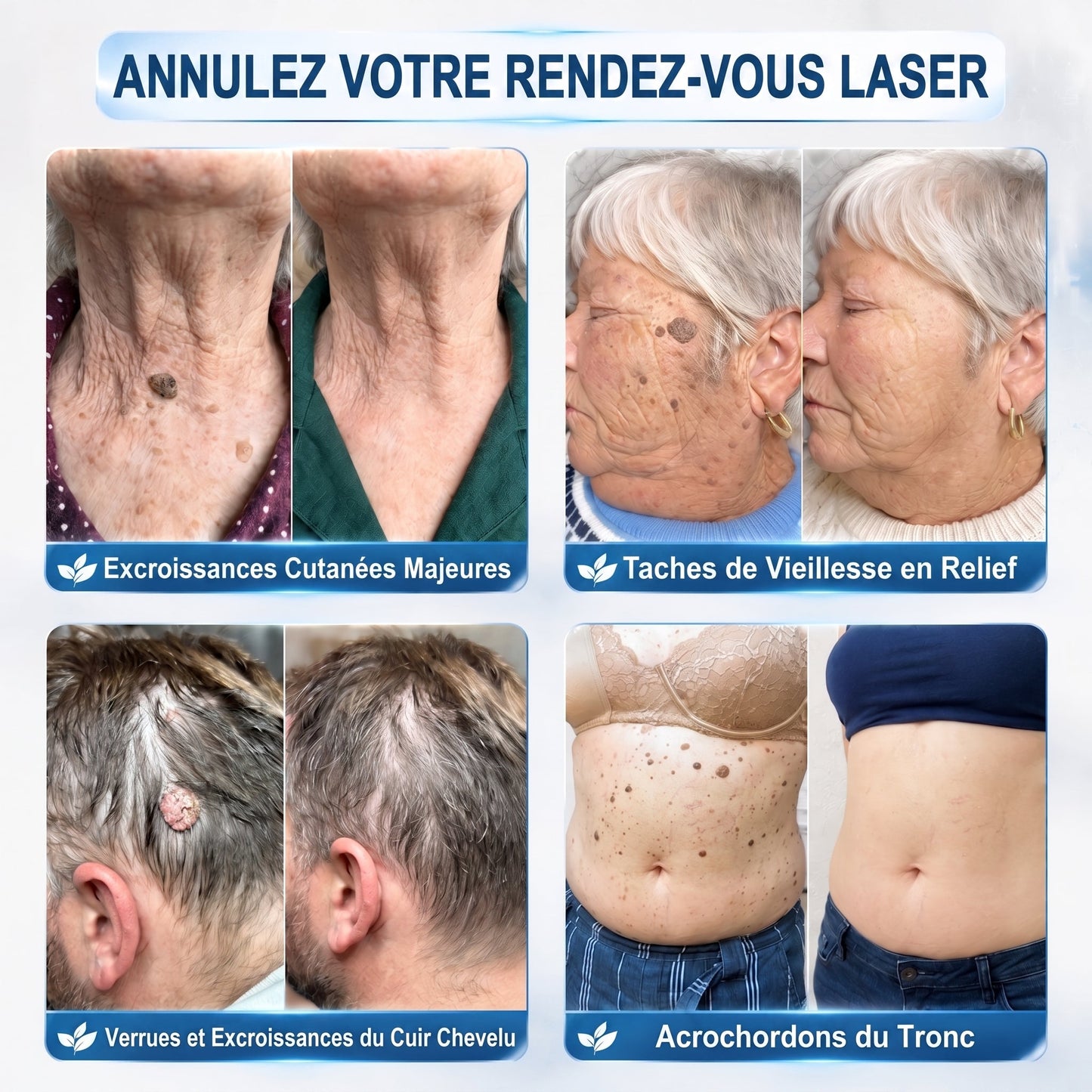 Recommandé par les pharmaciens 👨‍⚕️ 𝑯𝒆𝒂𝒍𝒓𝒊𝒛𝒆® 𝑺𝒕𝒚𝒍𝒐 𝑹𝒐𝒍𝒍𝒆𝒓 𝑨𝒏𝒕𝒊-𝑰𝒎𝒑𝒆𝒓𝒇𝒆𝒄𝒕𝒊𝒐𝒏𝒔 7 𝑱𝒐𝒖𝒓𝒔 𝑺𝒂𝒏𝒔 𝒅𝒐𝒖𝒍𝒆𝒖𝒓 • 𝑺𝒂𝒏𝒔 𝒎𝒂𝒓𝒒𝒖𝒆𝒔 𝒗𝒊𝒔𝒊𝒃𝒍𝒆𝒔